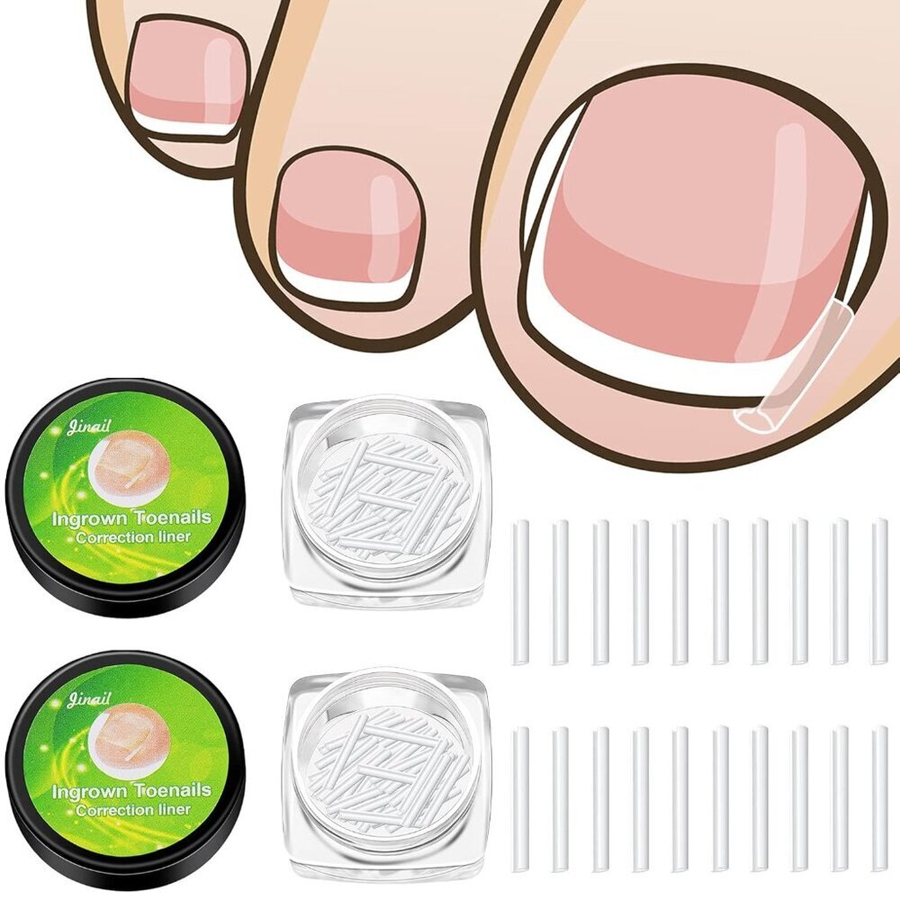 100 Pieces Ingrown Toenail Corrector Strips Toenail Correction Patches Curved To